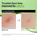 Anua - Azelac Acid 10 Hyaluron Redness Soothing Serum 30ml