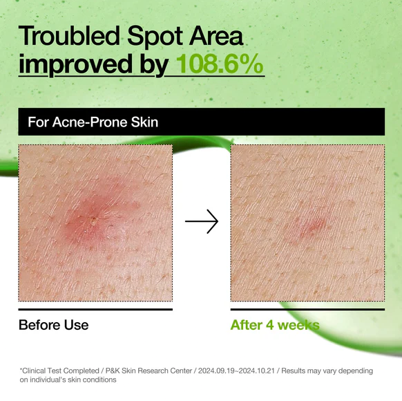 Anua - Azelac Acid 10 Hyaluron Redness Soothing Serum 30ml