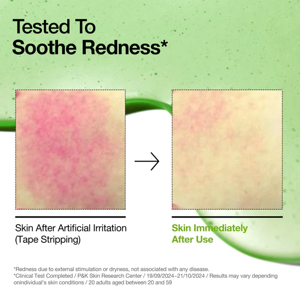 Anua - Azelac Acid 10 Hyaluron Redness Soothing Serum 30ml